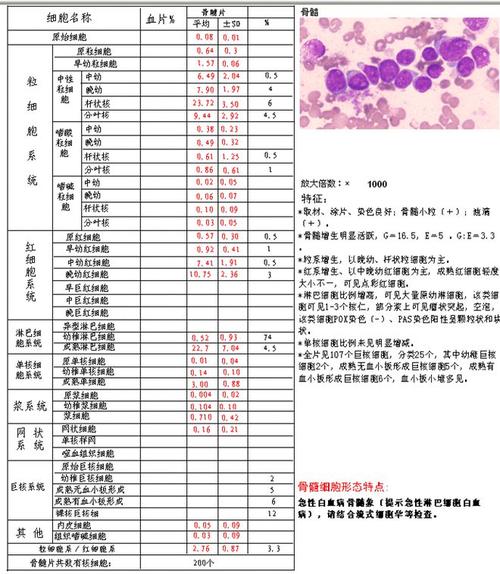 肺炎数据接口骨髓涂片数据(肺炎骨髓穿刺)