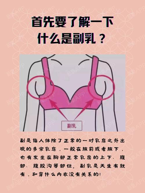 副乳健康知识女生变美知识(副乳科普)