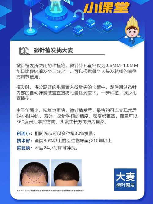 植发多少钱一个毛囊(大麦微针植发多少钱一个毛囊)