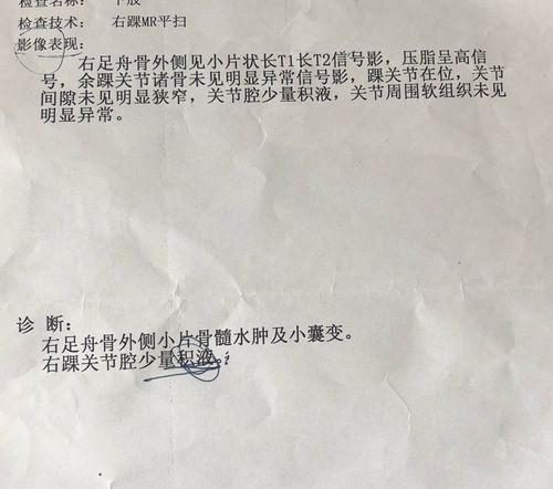 杭州高信催收员待遇(杭州高信催收员待遇如何)