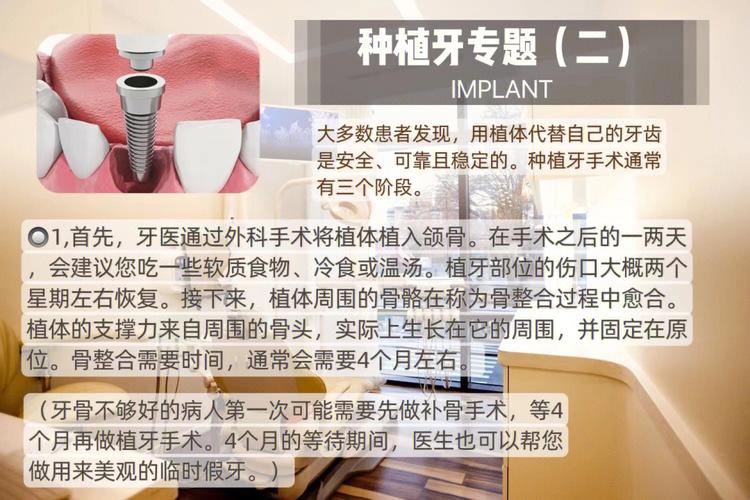 关于牙科知识文章标题-{下拉词