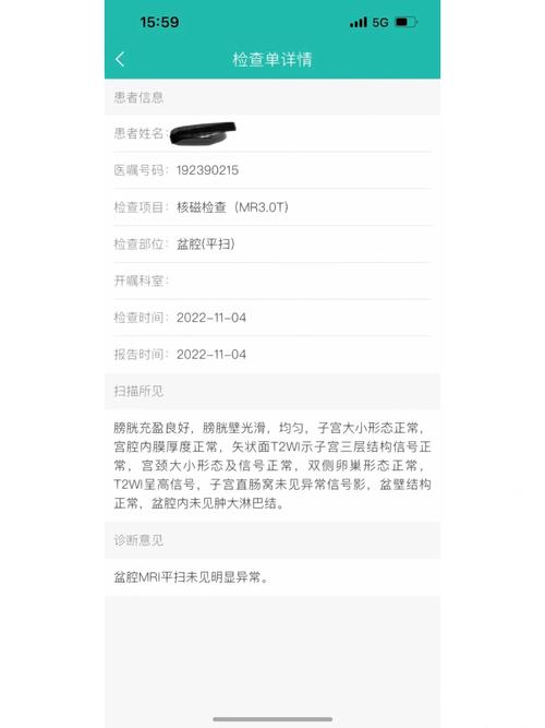 异常子宫出血知识科普文章-{下拉词