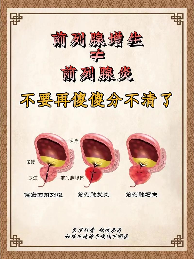 男科知识文章-{下拉词