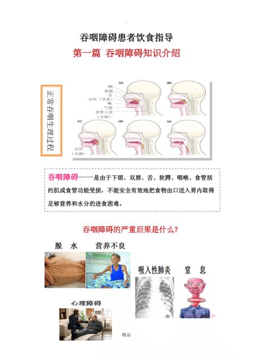 吞咽障碍知识科普文章范文(吞咽障碍宣传册)