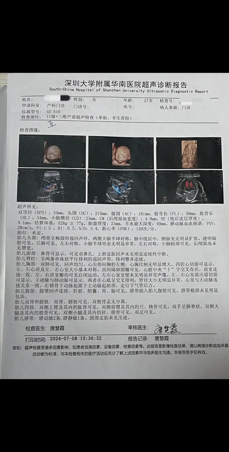 四维彩超数据分析-{下拉词